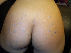 De la cire de bougies sur le cul